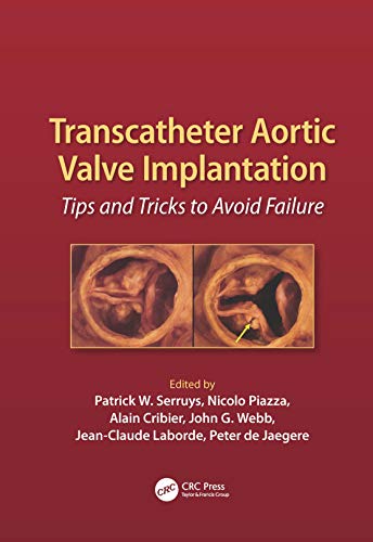 Imagen de archivo de Transcatheter Aortic Valve Implantation: Tips and Tricks to Avoid Failure a la venta por Your Online Bookstore
