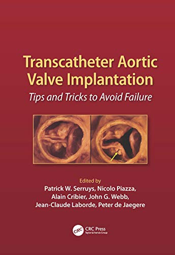 Stock image for Transcatheter Aortic Valve Implantation: Tips and Tricks to Avoid Failure [With DVD] for sale by ThriftBooks-Atlanta