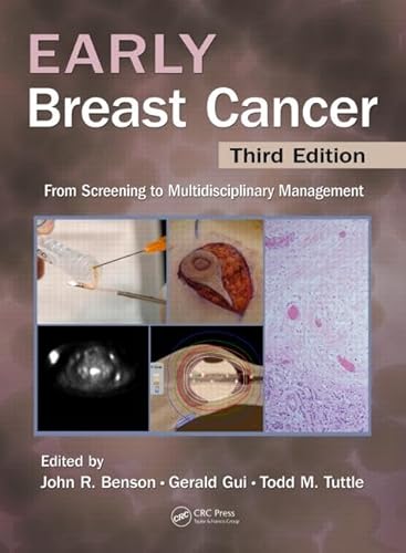 9781841848853: Early Breast Cancer