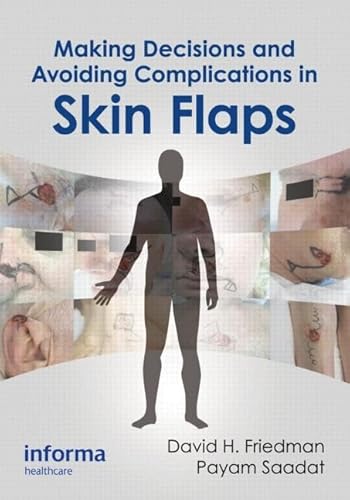 9781841849850: Making Decisions and Avoiding Complications in Skin Flaps