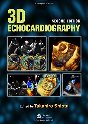 9781841849935: 3D Echocardiography