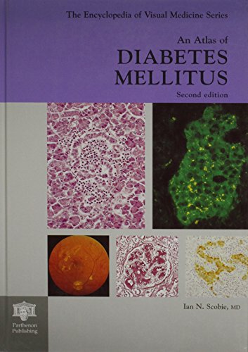 9781842140093: An Atlas of Diabetes Mellitus, Second Edition (Encyclopedia of Visual Medicine Series)