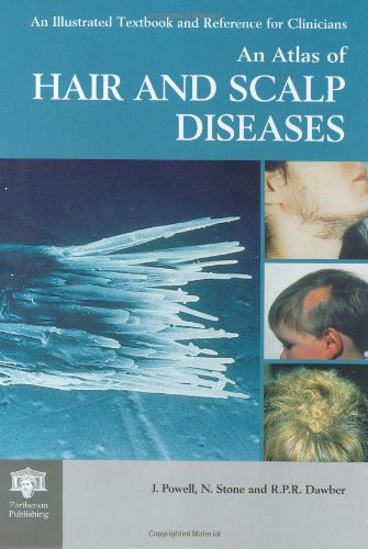 Stock image for An Atlas of Hair and Scalp Diseases for sale by Better World Books Ltd