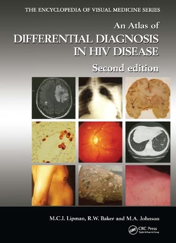 Stock image for An Atlas of Differential Diagnosis in HIV Disease for sale by Better World Books Ltd