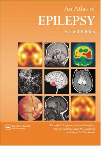 Imagen de archivo de Atlas of Epilepsy a la venta por Better World Books