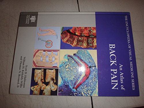 Beispielbild fr An Atlas of Back Pain (The Encyclopedia of Visual Medicine) zum Verkauf von WorldofBooks