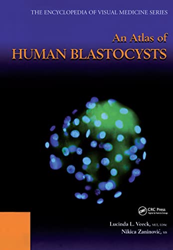 9781842141694: An Atlas of Human Blastocysts (Encyclopedia of Visual Medicine Series, 59)