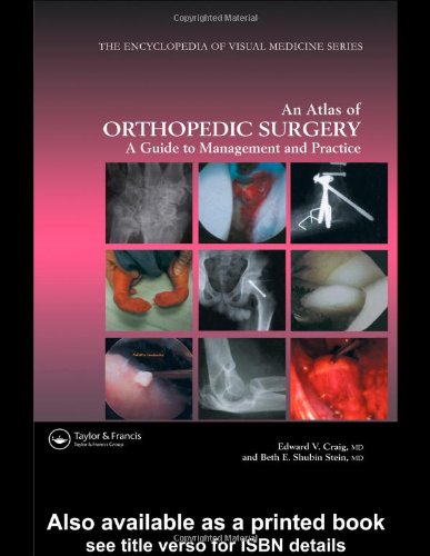 9781842141854: Atlas of Orthopedic Surgery: A Guide to Management and Practice (Encyclopedia of Visual Medicine Series)