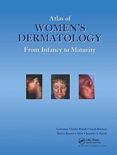 Stock image for Atlas of Women's Dermatology for sale by Blackwell's