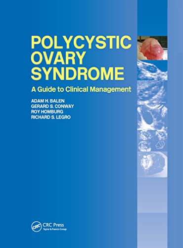 Stock image for Polycystic Ovary Syndrome: A Guide to Clinical Management for sale by Anybook.com