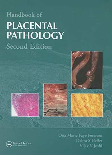 Stock image for Handbook of Placental Pathology for sale by Red's Corner LLC