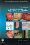 Beispielbild fr An Atlas of Atopic Eczema (Encyclopedia of Visual Medicine Series) zum Verkauf von WorldofBooks