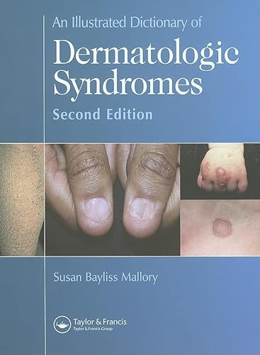 Stock image for An Illustrated Dictionary of Dermatologic Syndromes for sale by Webbooks, Wigtown