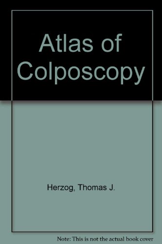 Atlas of Colposcopy (9781842142677) by Herzog, Thomas J.; Coleman, Robert L.; Massad, F. Stewart