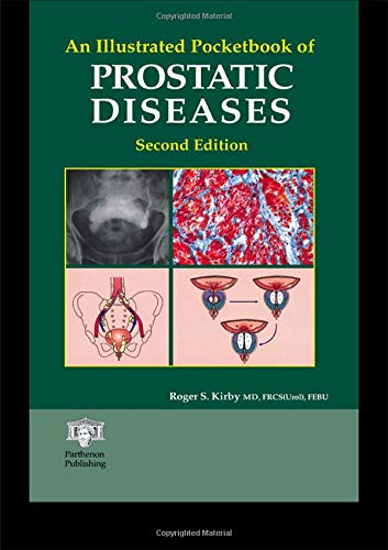 An Illustrated Pocketbook of Prostatic Disease (9781842142714) by Kirby, Roger