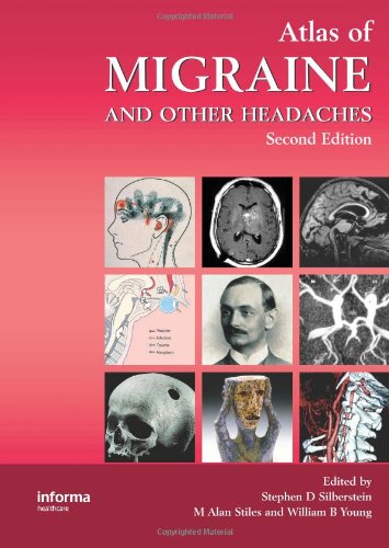 Imagen de archivo de Atlas of Migrane and Other Headaches a la venta por Better World Books