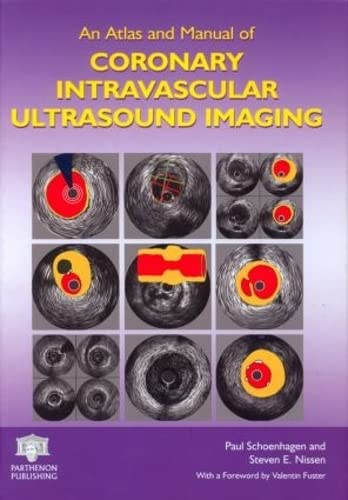 Stock image for An Atlas and Manual of Coronary Intravascular Ultrasound Imaging for sale by Books Puddle