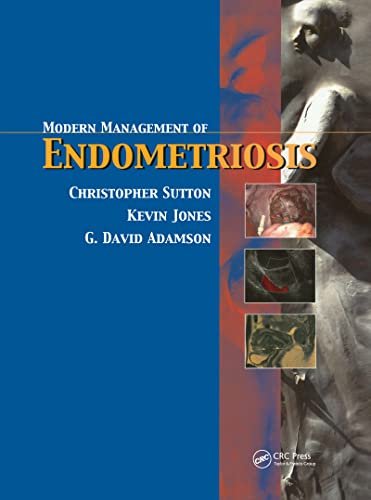 Imagen de archivo de Modern Management of Endometriosis a la venta por Chiron Media