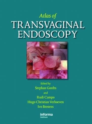 Stock image for Atlas of Transvaginal Endoscopy for sale by Revaluation Books