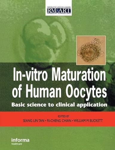 9781842143322: In Vitro Maturation of Human Oocytes: Basic Science to Clinical Applications: 2 (Reproductive Medicine & Assisted Reproductive Techniques)