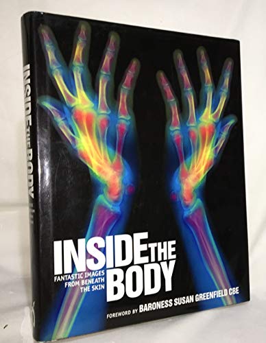 9781844031832: Inside the Body: Fantastic Images from Beneath the Skin