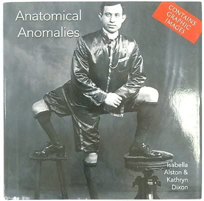 Stock image for Anatomical Anomalies (Minibooks) for sale by ThriftBooks-Atlanta