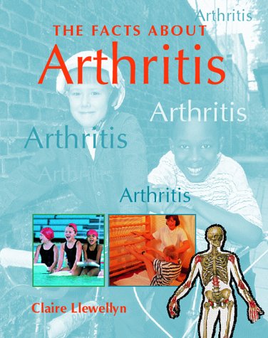 9781844582259: FACTS ABOUT ARTHRITIS