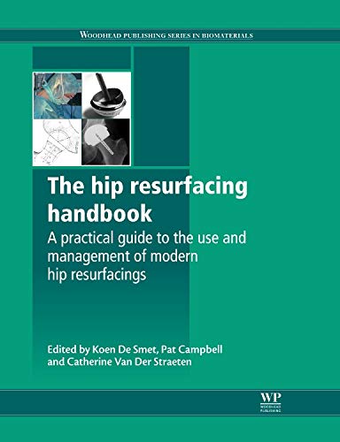 9781845699482: The Hip Resurfacing Handbook: A Practical Guide to the Use and Management of Modern Hip Resurfacings