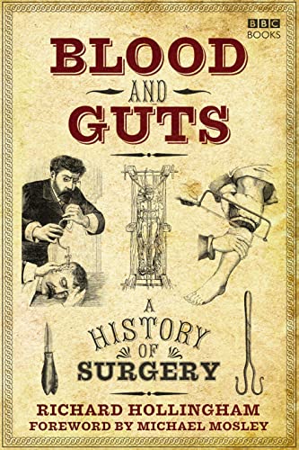 Beispielbild fr Blood and Guts: A History of Surgery zum Verkauf von Reuseabook