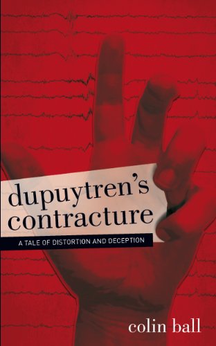 9781846244889: Dupuytren's Contracture