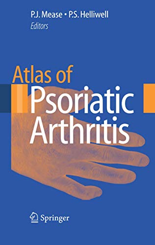 Atlas of Psoriatic Arthritis [Hardcover] Mease, Philip J. and Helliwell, Philip S.