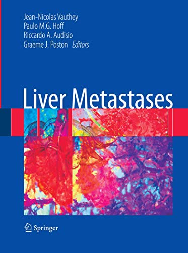 Beispielbild fr Liver Metastases zum Verkauf von Better World Books Ltd