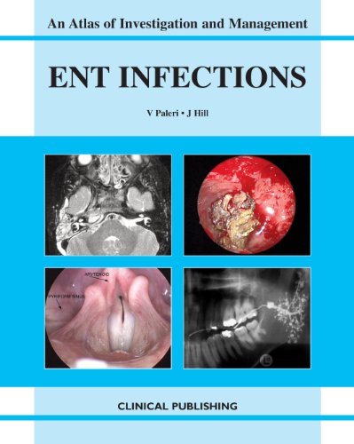Beispielbild fr ENT Infections (Atlas of Investigation and Management) zum Verkauf von Bestsellersuk