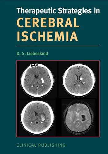 9781846920455: Therapeutic Strategies in Cerebral Ischemia