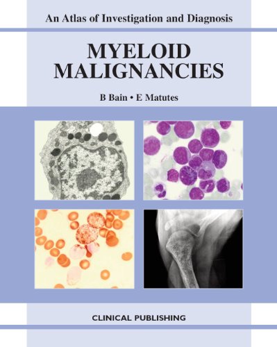 9781846920554: Myeloid Malignancies: An Atlas of Investigation and Diagnosis