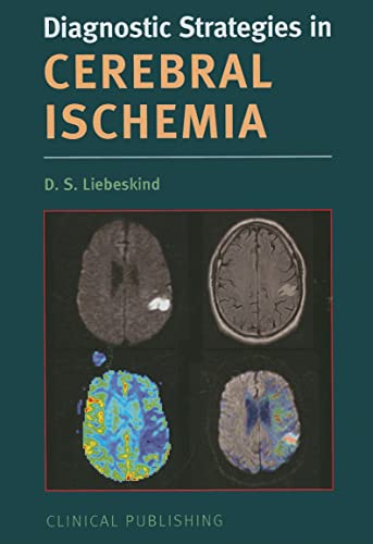Beispielbild fr Cerebral Ischemia (Diagnostic Strategies) zum Verkauf von Y-Not-Books