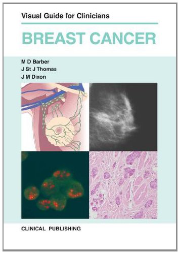 Imagen de archivo de Breast Cancer Visual Guide for Clinicians a la venta por PBShop.store US
