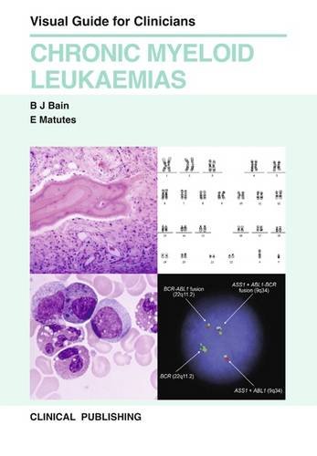 9781846920943: Chronic Myeloid Leukaemias (Visual Guide for Clinicians)