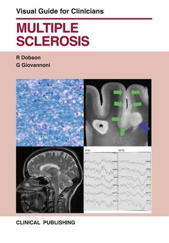 Beispielbild fr Multiple Sclerosis (Visual Guide for Clinicians) zum Verkauf von AwesomeBooks