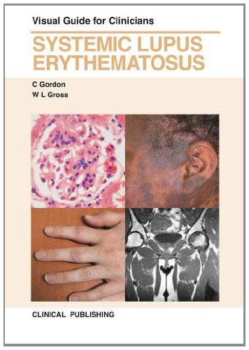 Imagen de archivo de Systemic Lupus Erythematosus : Visual Guide for Clinicians a la venta por Buchpark