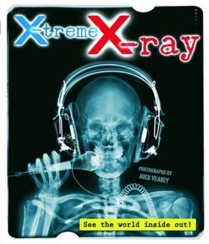 Stock image for X-treme X-ray for sale by WorldofBooks