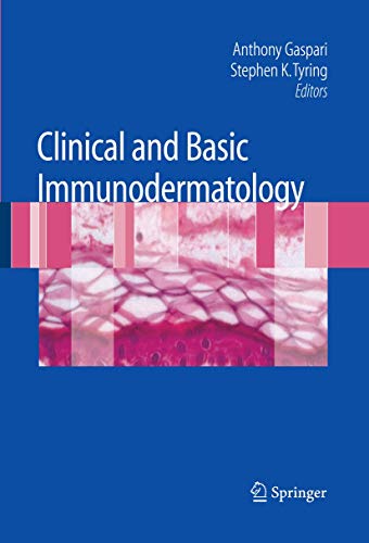 9781848001640: Clinical and Basic Immunodermatology: Clinical Diagnosis and Management