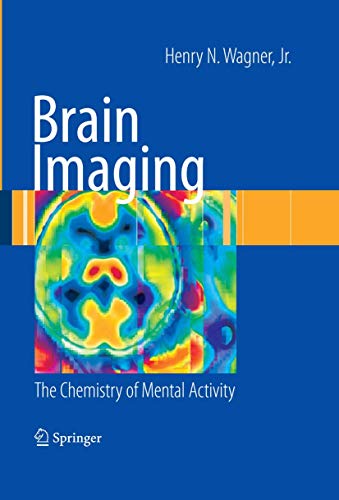 Beispielbild fr Brain Imaging. The Chemistry of Mental Activity. zum Verkauf von Gast & Hoyer GmbH