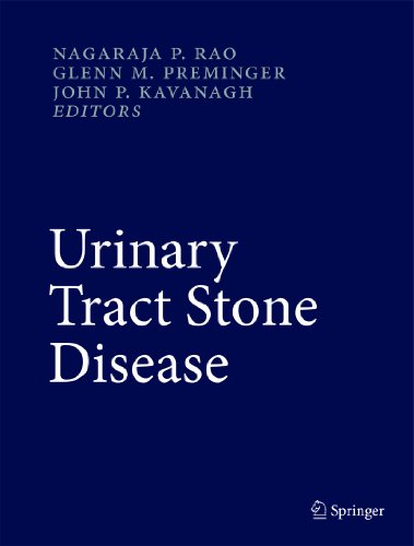 Imagen de archivo de Urinary Tract Stone Disease a la venta por Buchpark