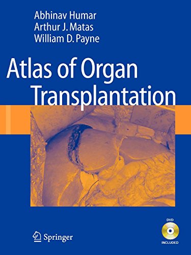 9781848004771: Atlas of Organ Transplantation