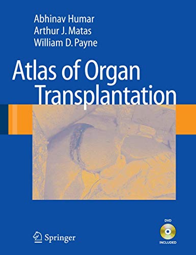 Imagen de archivo de Atlas of Organ Transplantation a la venta por Lucky's Textbooks