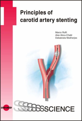 Stock image for Principles of Carotid Artery Stenting (Uni-Med Science) for sale by RiLaoghaire