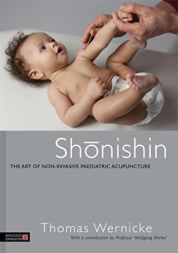9781848191600: Shonishin: The Art of Non-Invasive Paediatric Acupuncture