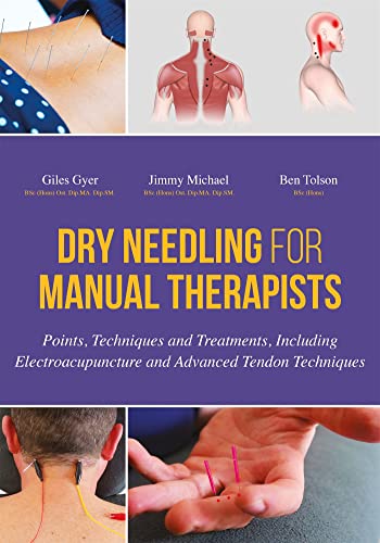 9781848192553: Dry Needling for Manual Therapists: Points, Techniques and Treatments, Including Electroacupuncture and Advanced Tendon Techniques