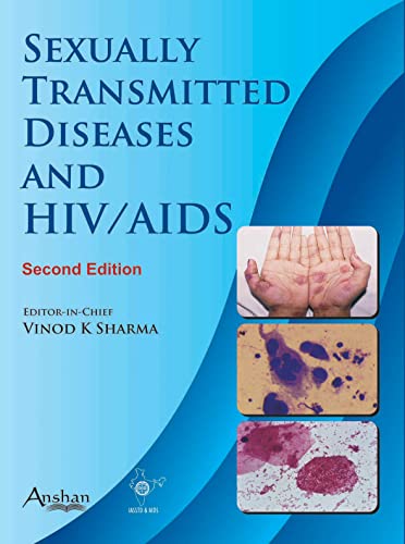 Beispielbild fr Sexually Transmitted Diseases and Aids zum Verkauf von Anybook.com